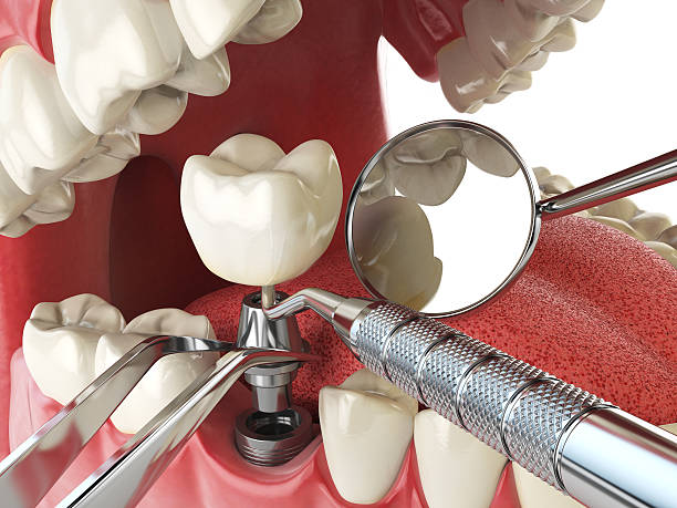 Best Walk-In Emergency Dental Services in Auburn, NE