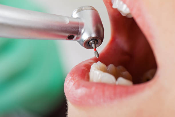 Best Weekend Emergency Dental Services in Auburn, NE
